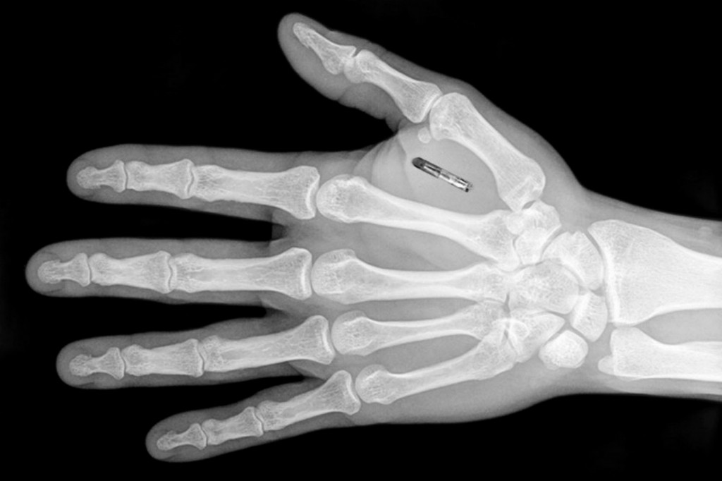 微型晶片如米粒大小，置於拇指及食指之間。（網上圖片）