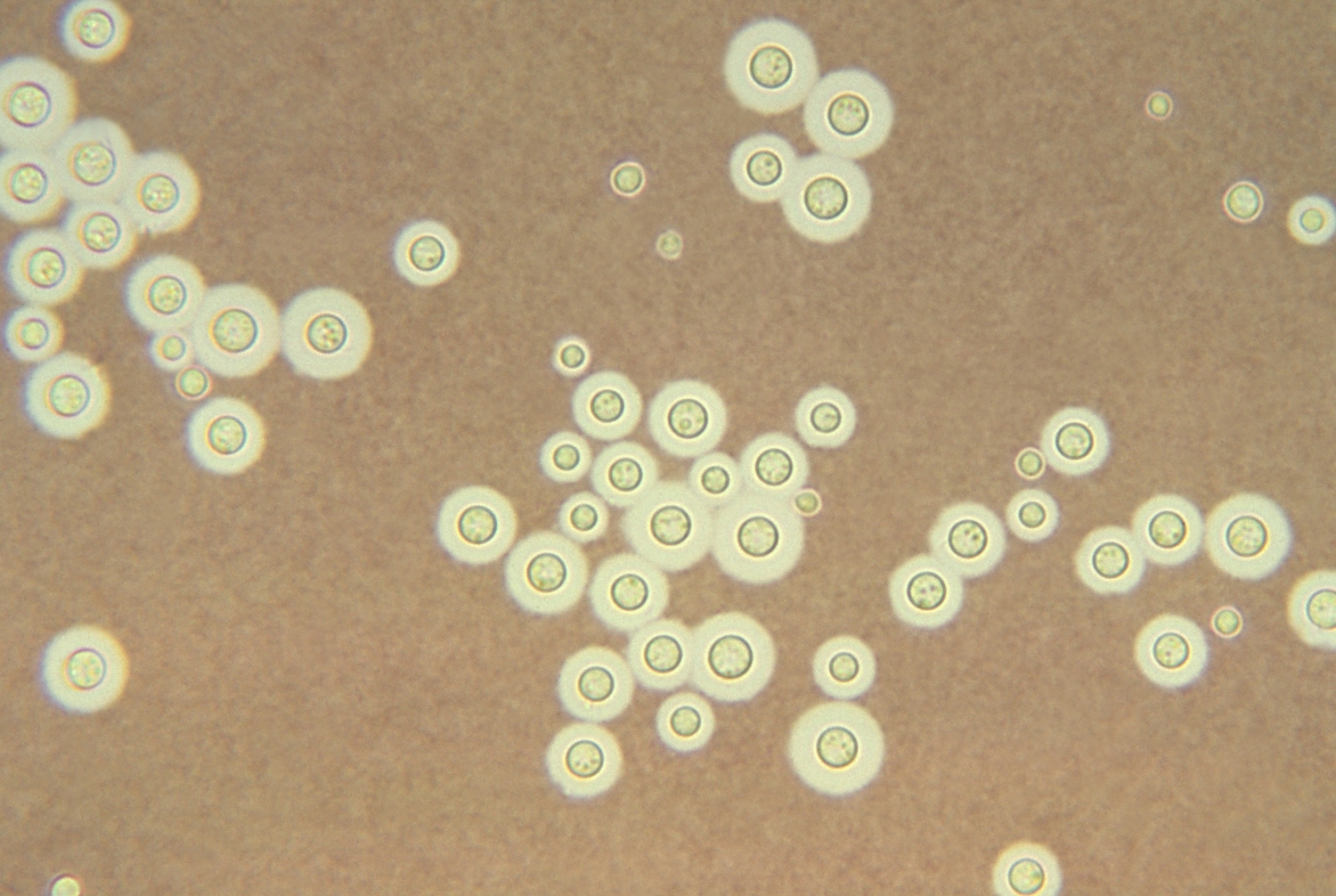 新型隱球菌具備黑色素，可以吸收輻射成長。（維基百科圖片）