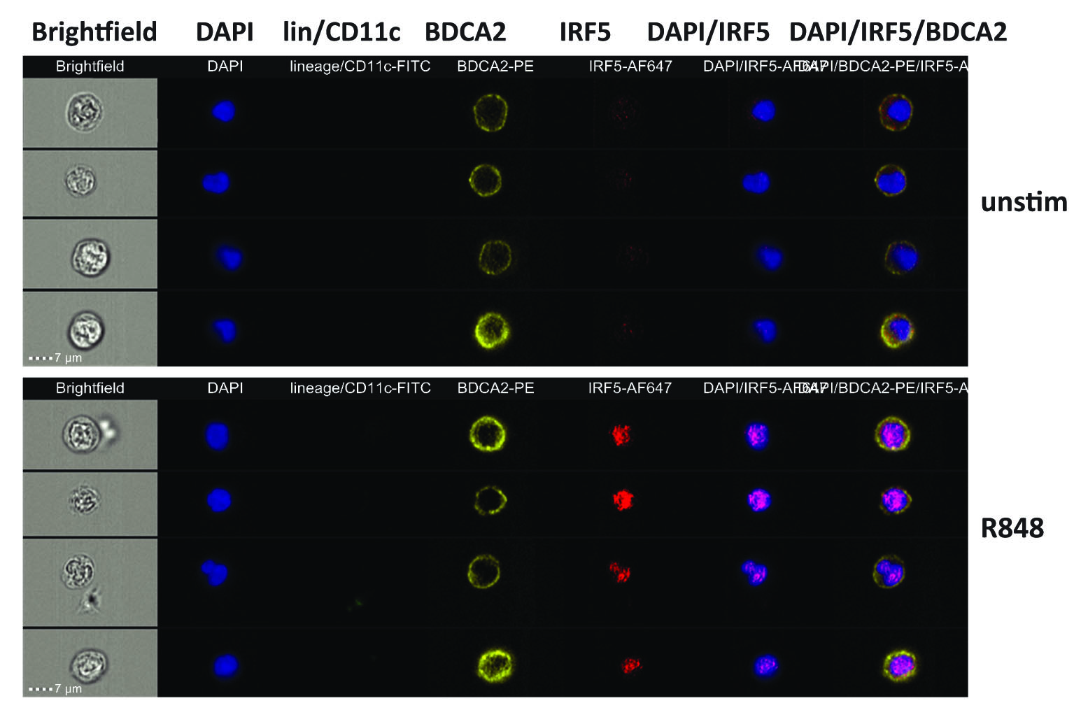 左邊灰色列是漿細胞樣樹突狀細胞在顯微鏡下的影像， 此圖顯示它在自然情況下（Unstim）和受抗癌藥物治療後（R848）的反應。（城大圖片）
