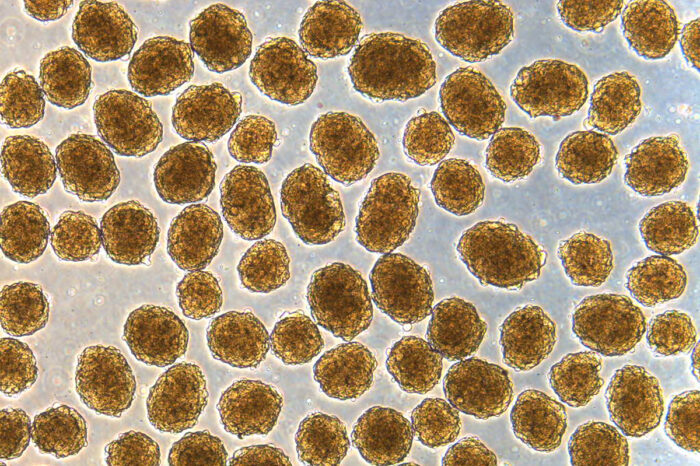 顯微鏡下觀察到的β細胞群，用作分泌控制血糖的胰島素。（華盛頓大學圖片）