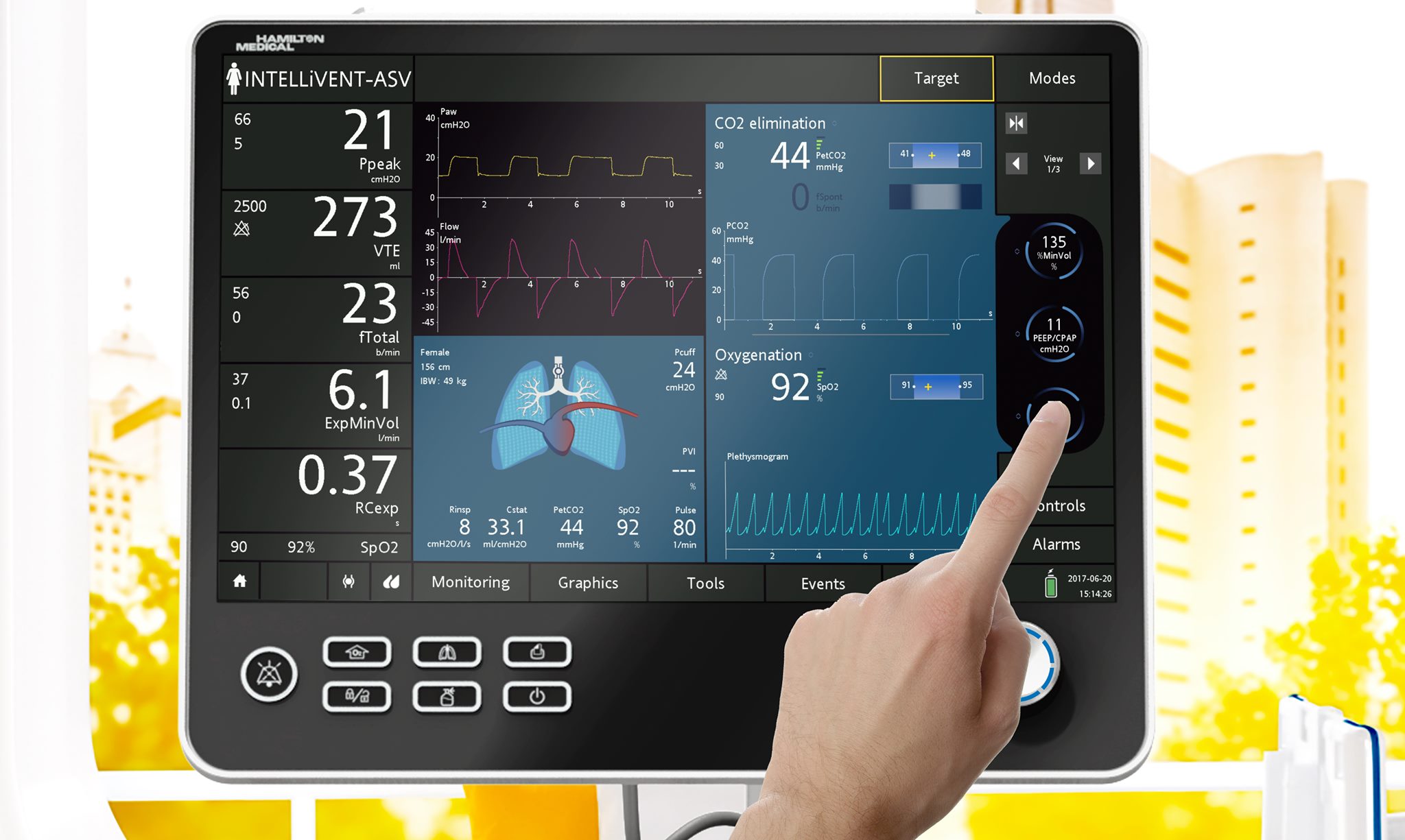 圖中為一款iPad及Mac電腦的模擬器程式，具備真實Hamilton-C6呼吸機的操作介面。（Hamilton Medical圖片）