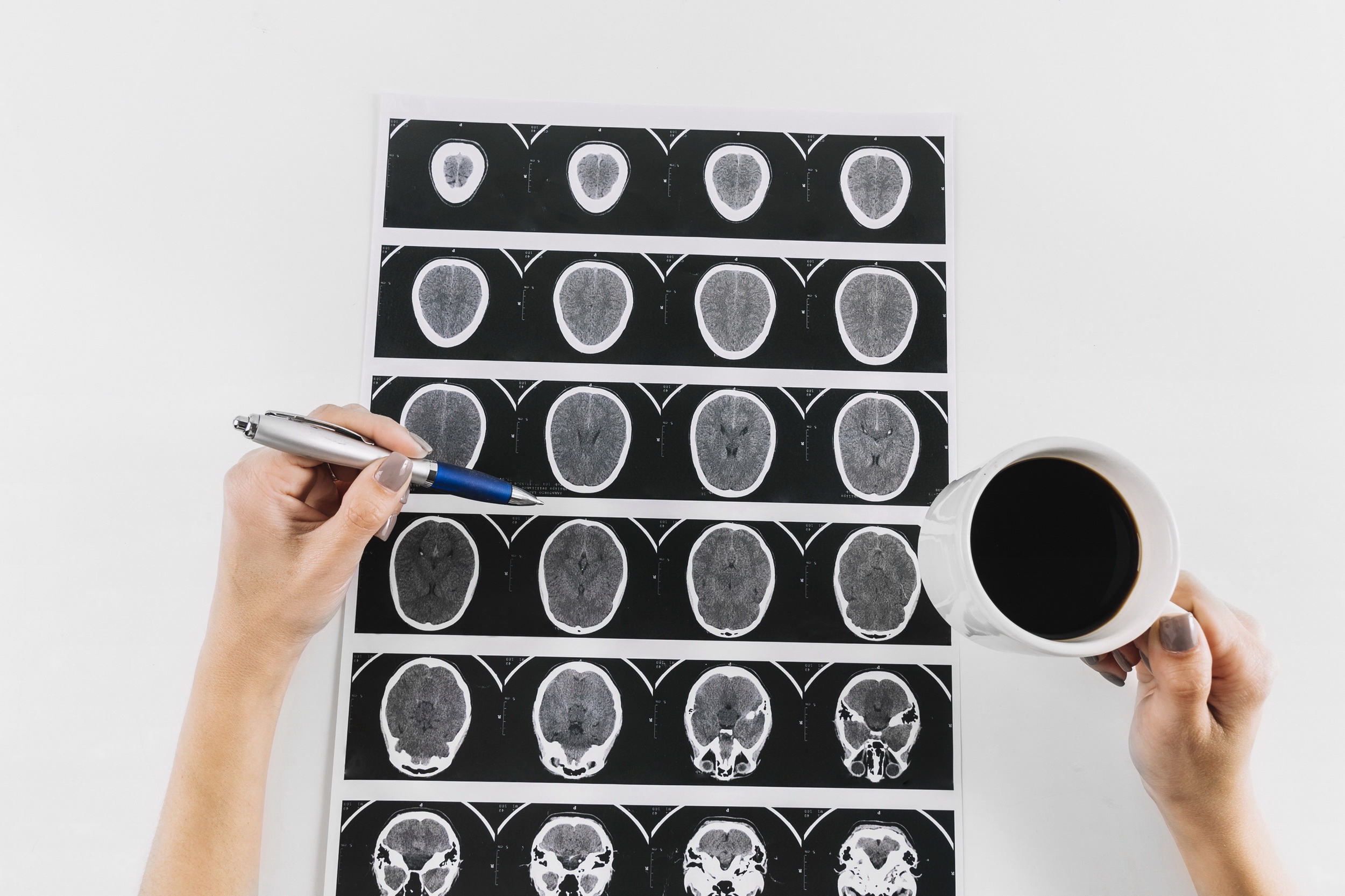 英特爾夥拍賓大佩雷爾曼醫學院，為腦腫瘤建立歷來最大的AI訓練模型。（英特爾圖片）