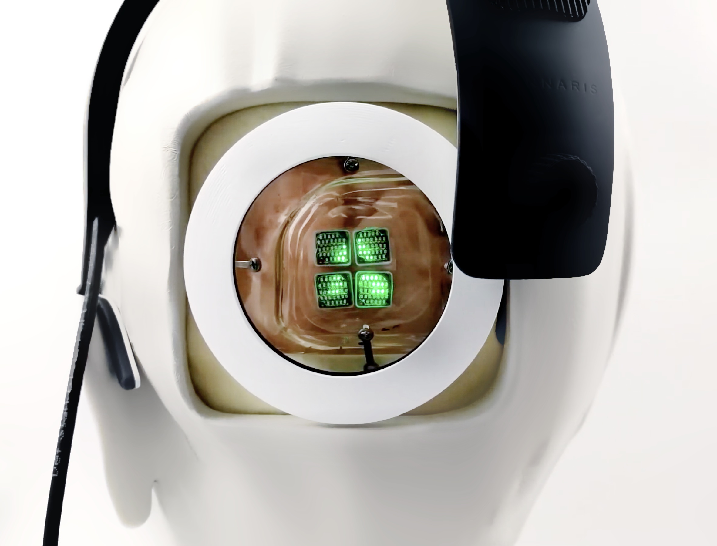 澳洲蒙納許大學把微電極，植入大腦後方的皮層，接收電子眼的電脈衝訊號。（蒙納士大學圖片）