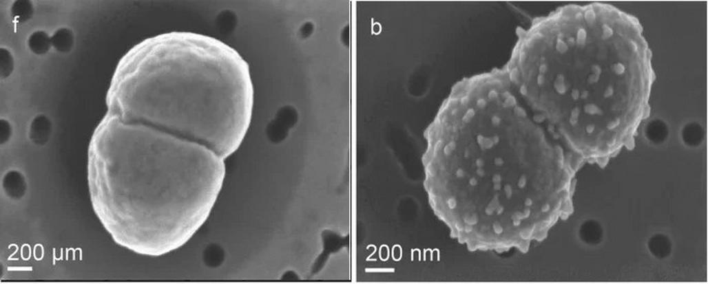 地球存在的樣本（左一），相比照射輻射後的奇異球菌（右一），後者表面長出大量小囊泡。（Microbiome圖片）