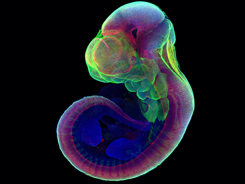 團隊認為，人造子宮有望協助研究員分析受精卵無法着床、自然流產等原因。（以色列魏茨曼科學研究學院圖片）