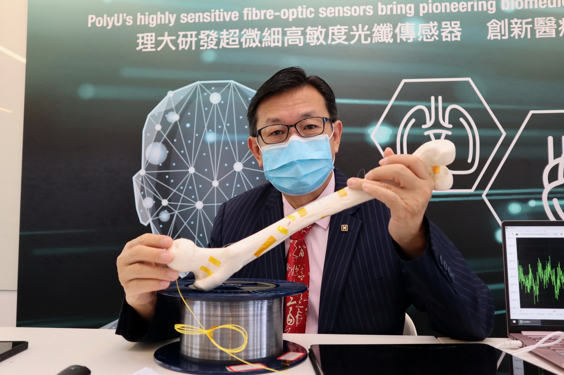 譚華耀表示，超微細光纖傳感器可植入骨折病人患處周邊骨骼，以監測癒合進度。（陳施敏攝）