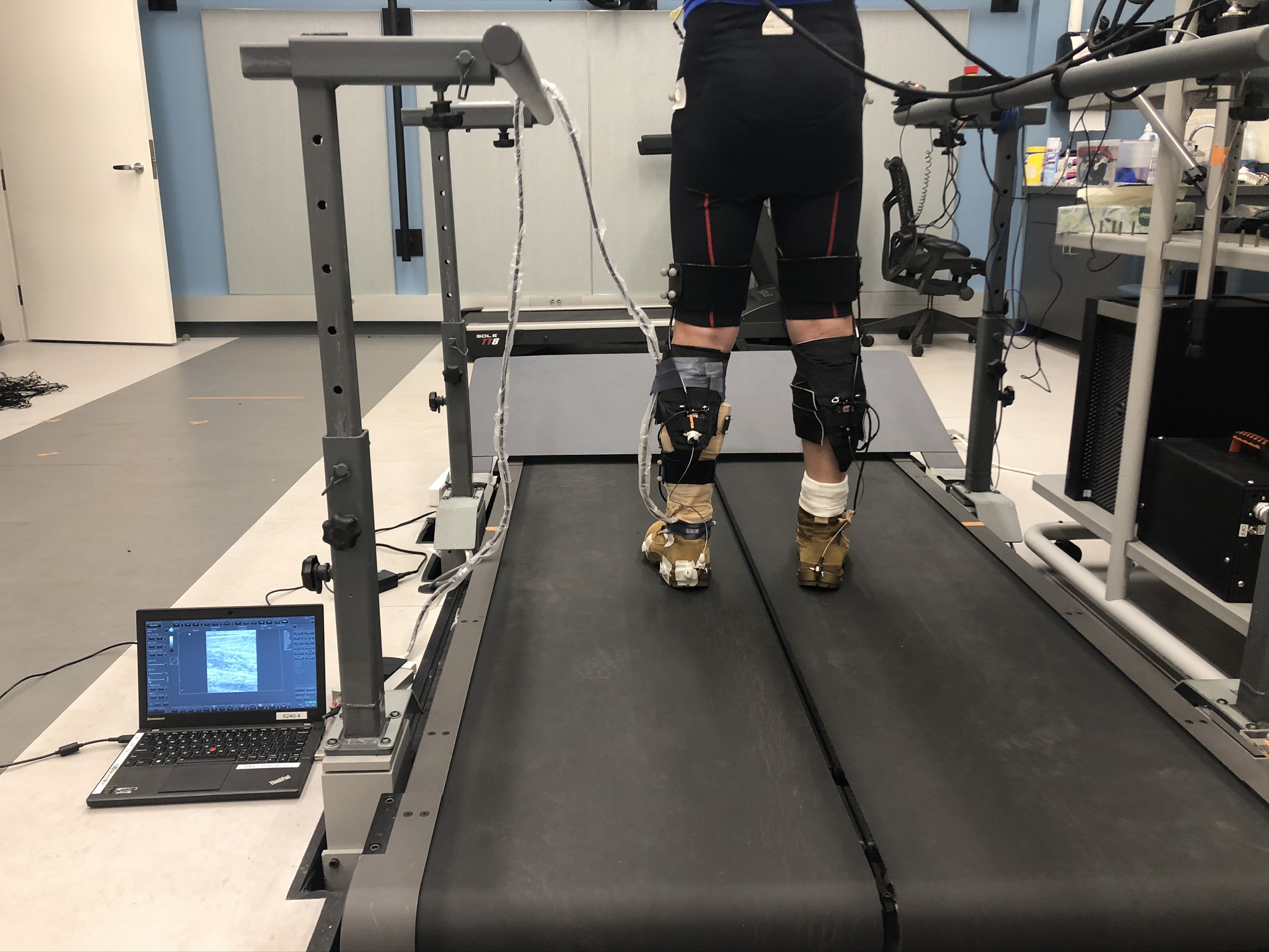 哈佛大學的研究團隊利用超聲波測量儀器偵測使用者在步行時的小腿肌肉活動，按個人情況調整外骨骼。（哈佛大學圖片）