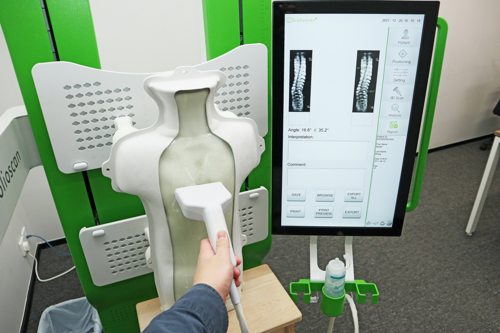 Scolioscan配合3D成像軟件，立體分析脊柱畸形情況。（陳偉健攝）