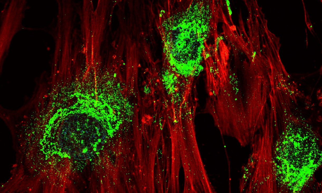 顯微鏡圖像顯示，當幹細胞轉化為骨細胞後，就會產生膠原蛋白（綠色部分）。（皇家墨爾本科技大學圖片）