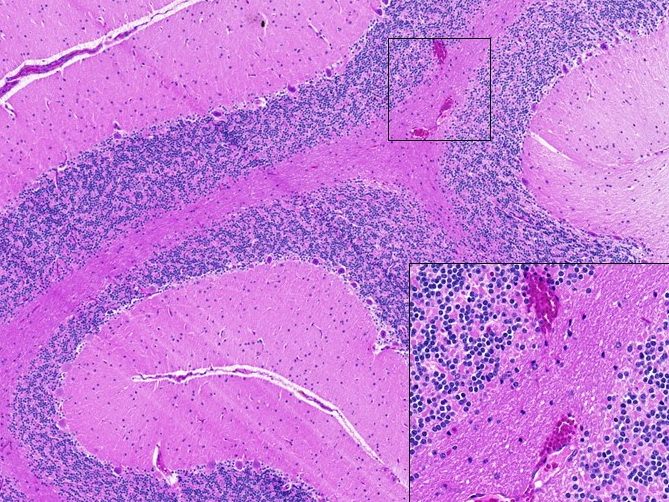感染新冠病毒非洲綠猴的腦組織顯示，有炎症及輕微出血現象。（杜蘭大學圖片）