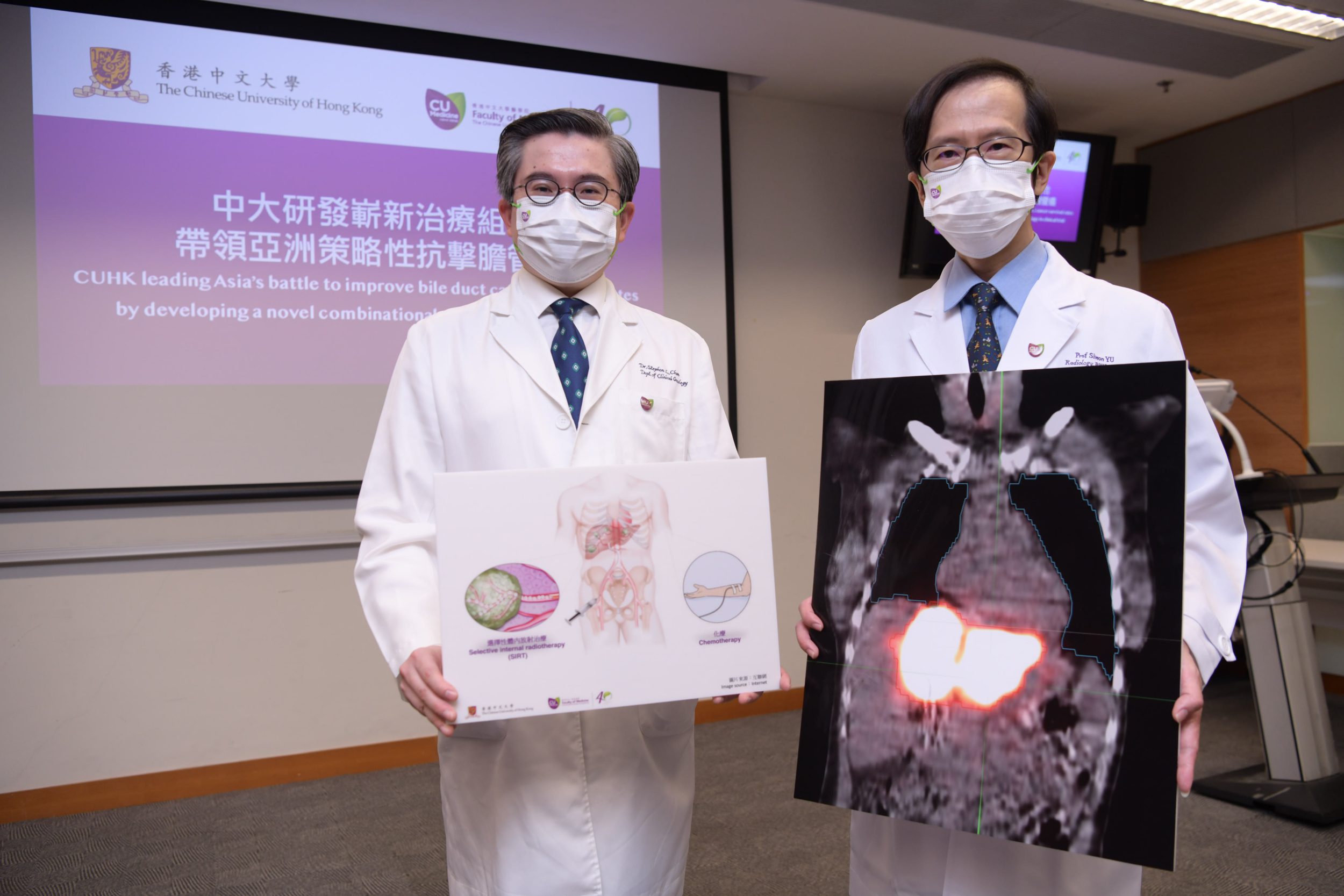 余俊豪（右）解釋，SIRT是把含有釔90的放射性物質，經動脈注射到肝臟腫瘤治療。（中大提供圖片）